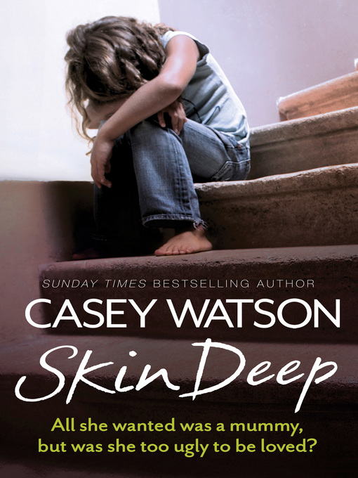 Title details for Skin Deep by Casey Watson - Available